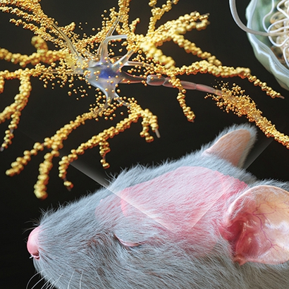 Molecular Imaging and Neurodevices